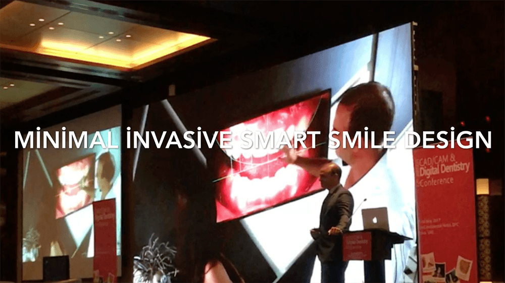 The Minimal Invasive Smart Smile Design
