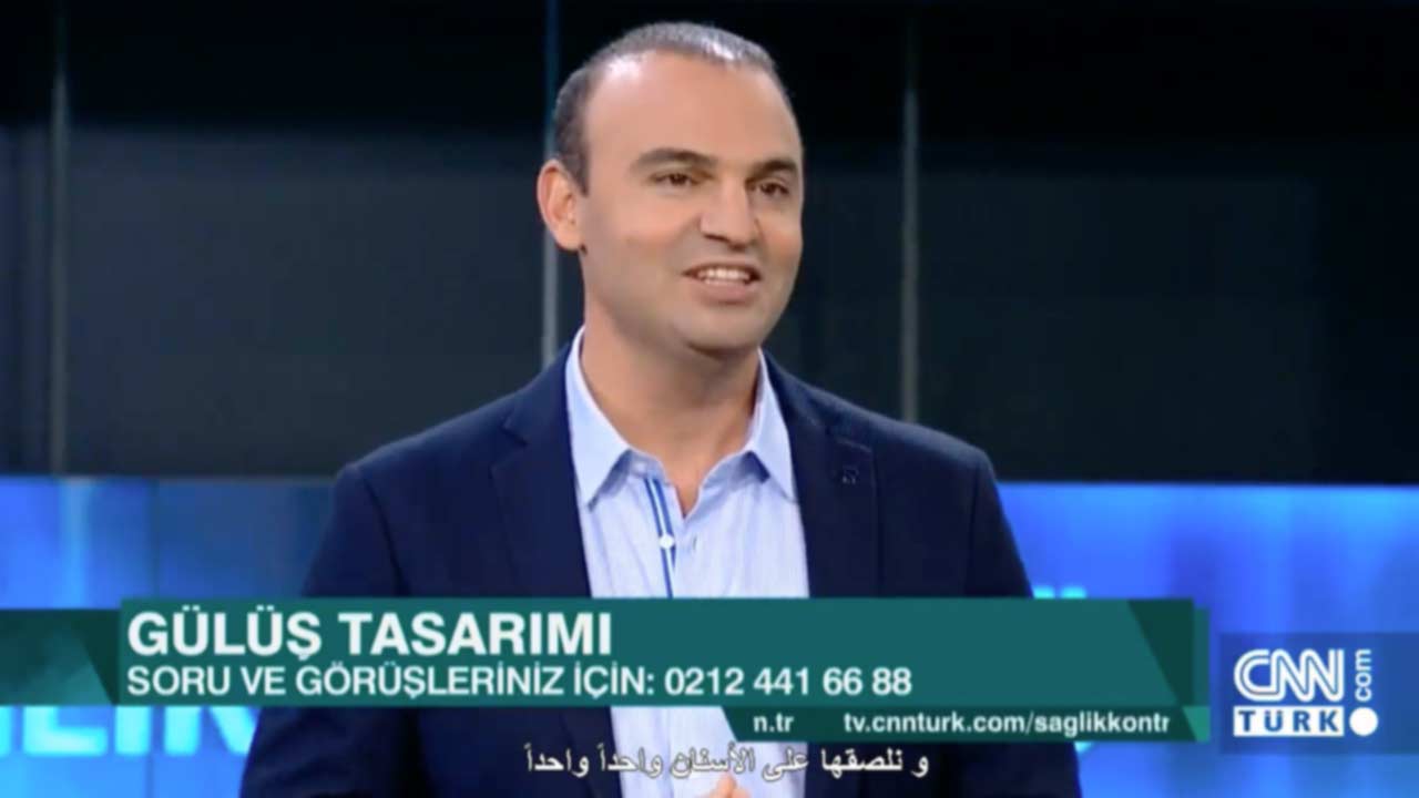 Gülüş Tasarımı