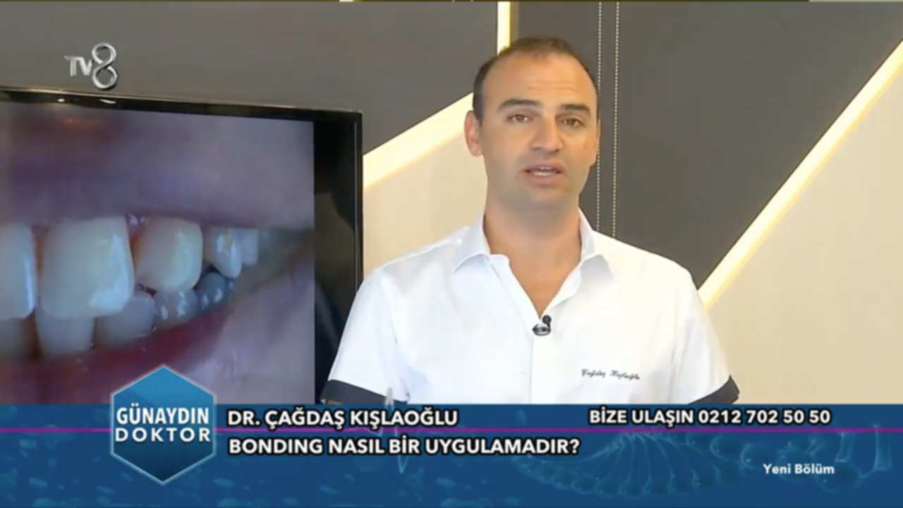 Diş Eti Estetiği